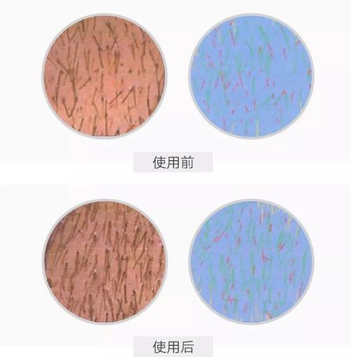 楊冪發(fā)際線變低還長出許多小絨毛,真的去植發(fā)了